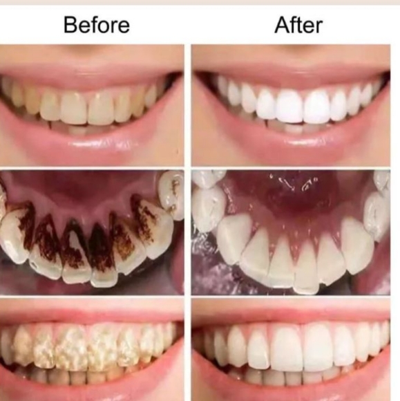 Konfy teeth whitening powder - Picture 2 of 2